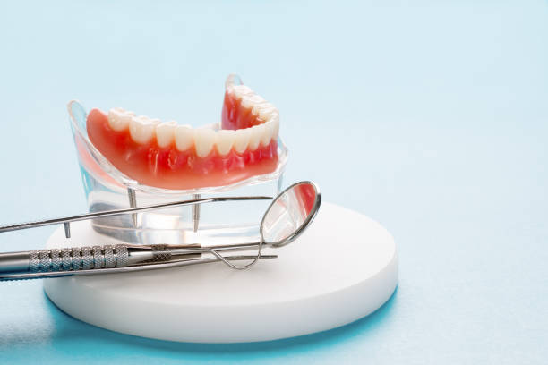 Dental Inlays and Onlays in Knox, IN