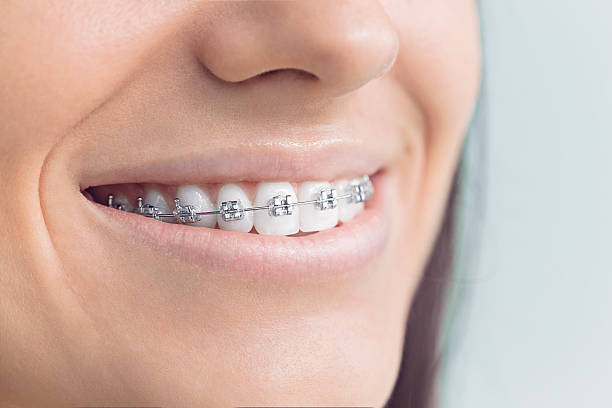 Best Teeth Whitening  in Knox, IN
